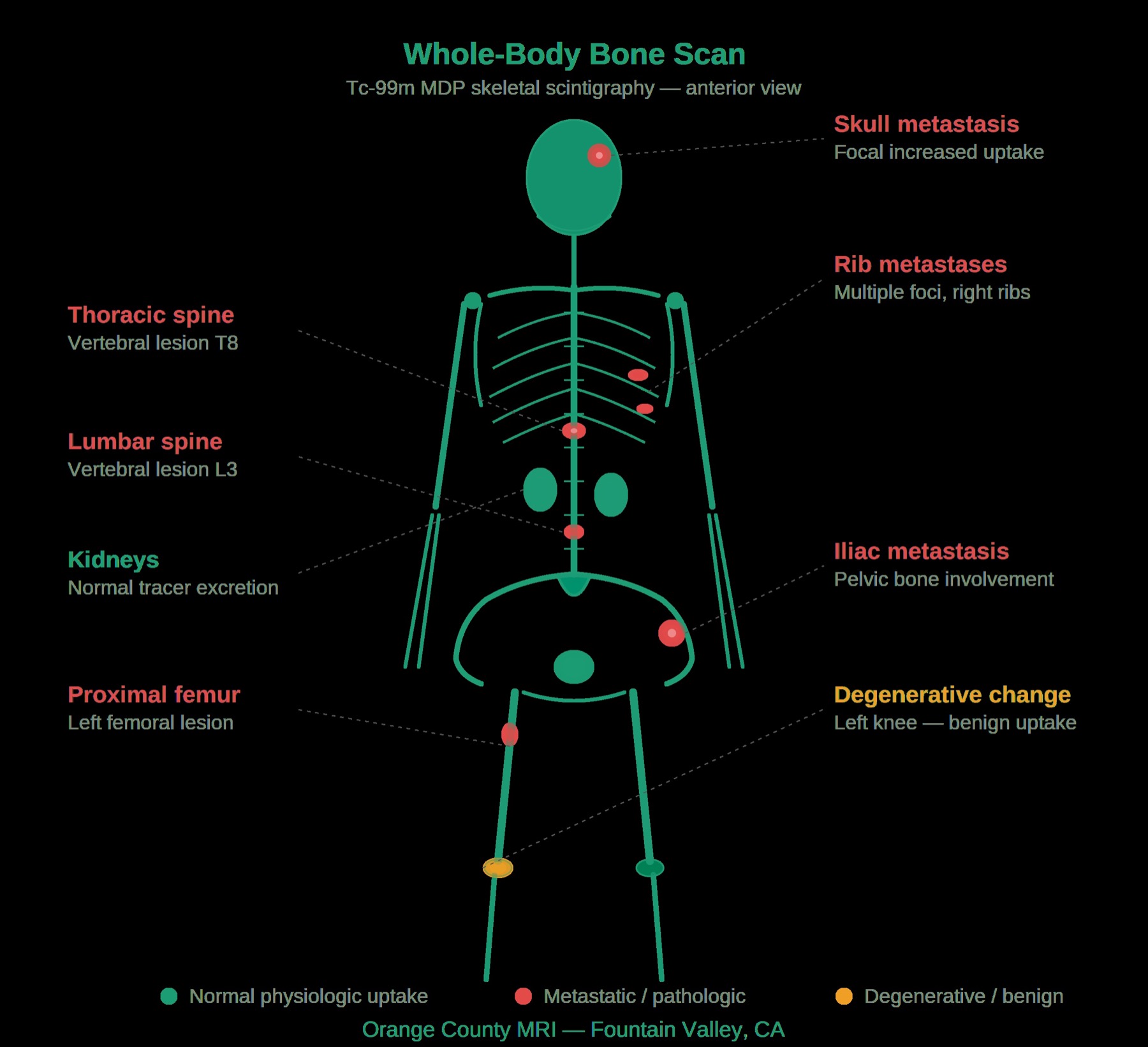 Bone scan imaging