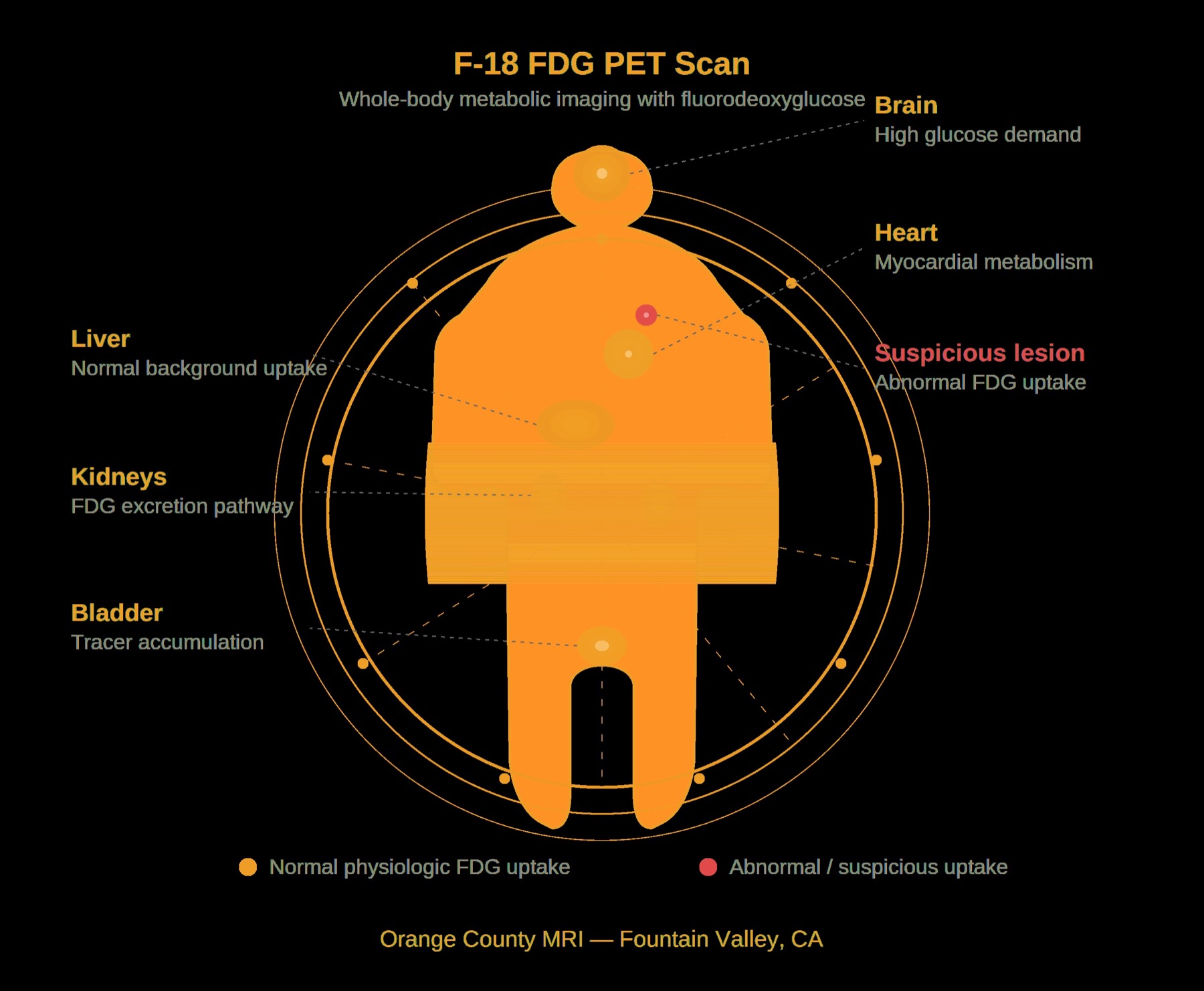 PET scan imaging